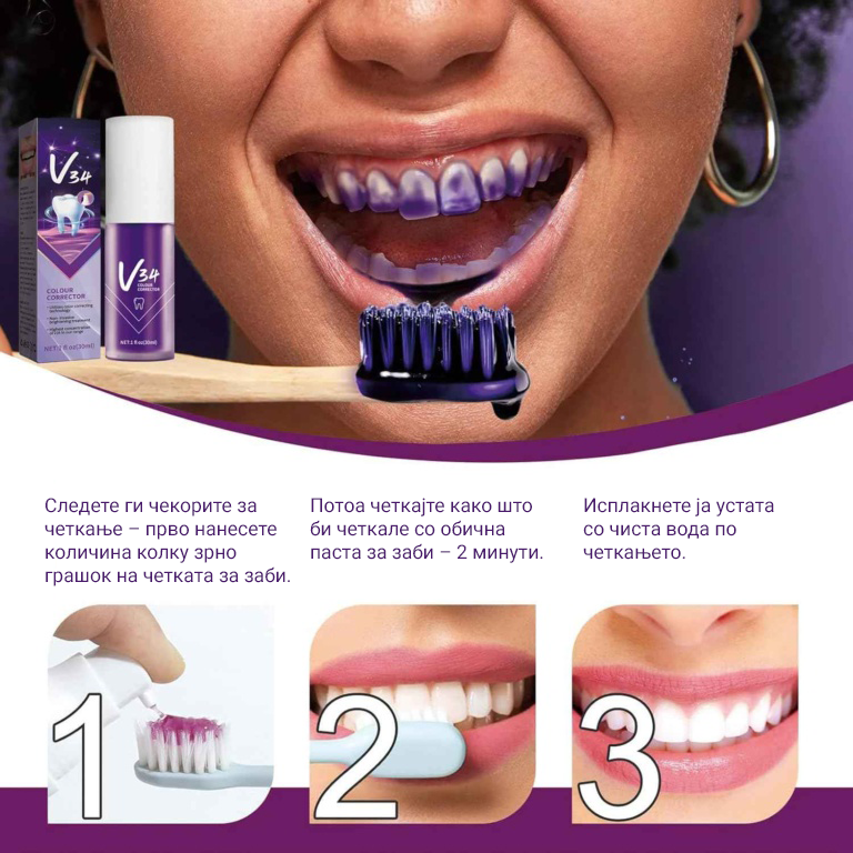 OUHOE V34 – Коректор за избелување на забите