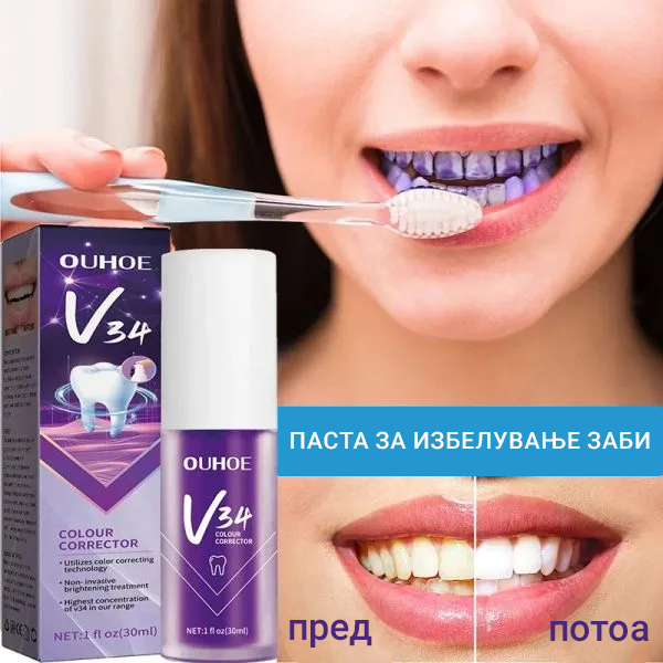 OUHOE V34 – Коректор за избелување на забите