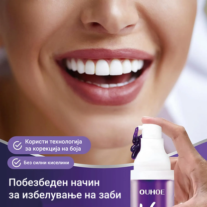 OUHOE V34 – Коректор за избелување на забите