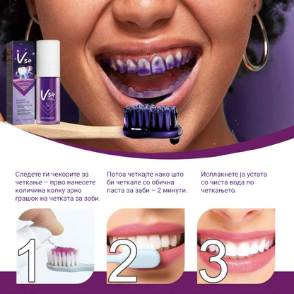 OUHOE V34 – Коректор за избелување на забите